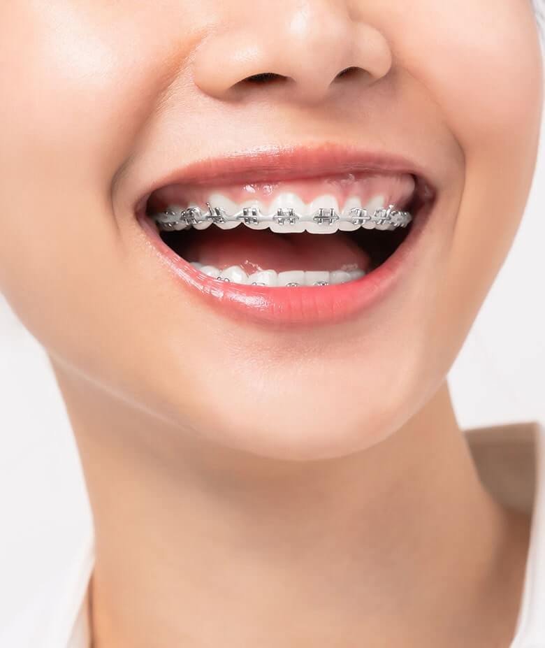 ortodonti – 1